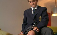 Bạn biết gì về bệnh 'vi khuẩn ăn thịt người'?