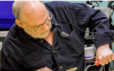 Phương pháp mới giúp người đột quỵ cử động được tay bị liệt