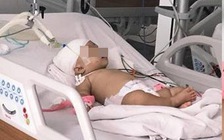 Khỉ sổng chuồng tấn công bé 14 tháng tuổi trọng thương