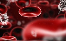 Làm sao tránh nguy cơ bị nhiễm trùng máu?