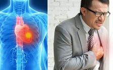 Những dấu hiệu cảnh báo một cơn đau tim sắp xảy ra