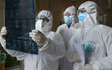 Đau đầu với dịch Covid-19