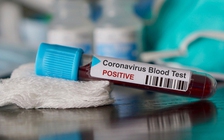 Một bác sĩ Anh 'bỏ túi' 1,7 triệu bảng nhờ bán bộ kit COVID-19 giá 'cắt cổ'