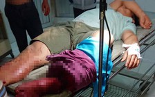 Nhóm bịt khẩu trang xông vào quán nhậu chém người