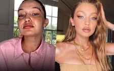 Nhan sắc Gigi Hadid thay đổi khi mang bầu