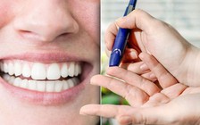 Thấy dấu hiệu này ở miệng, mau đi khám bệnh tiểu đường