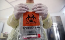 Khó lường chủng vi rút gây Covid-19