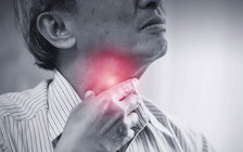 Ợ nóng lâu ngày, coi chừng mắc loại ung thư này!