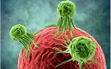 18 cách này giúp bạn giảm nguy cơ mắc bệnh ung thư