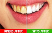 10 lỗi phổ biến về vệ sinh nhiều người mắc phải