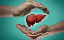 Có một chế độ ăn bảo vệ gan của bạn