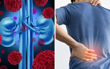 2 dấu hiệu ở lưng bạn cần chú ý đến thận