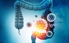 Cách nhận biết cơn đau bụng của bạn là do Omicron