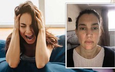 Hậu Covid-19, một phụ nữ bị triệu chứng đáng sợ này vào ban đêm