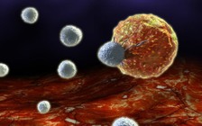 Biến đổi gien tế bào miễn dịch để diệt khối u ung thư