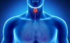 Công bố mới: Khối u tuyến giáp thực chất không phải là ung thư