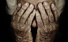 Mắc cao huyết áp dễ bị lẫn khi về già