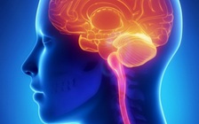 Phát hiện mới giúp người đột quỵ bị liệt hồi phục