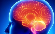 Biến đổi một chủng vi rút để tiêu diệt tế bào ung thư