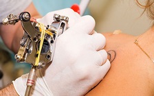 Mỹ cảnh báo tình trạng nhiễm trùng do xăm hình