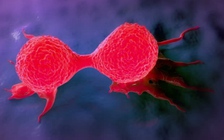 Ăn kiêng giúp ngừa ung thư vú