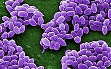 Protein tạo ra từ vi khuẩn gây bệnh than có thể trị ung thư