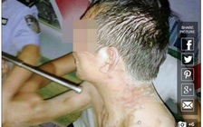 Phụ huynh lột truồng thầy giáo vì nghi sàm sỡ con gái ở Trung Quốc