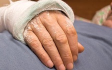 Vì sao vết thương người lớn tuổi lại lâu lành hơn người trẻ ?