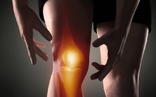 Làm thế nào để ngăn ngừa viêm khớp?