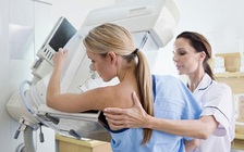 Phát hiện loại thuốc mới giúp chữa trị dạng ung thư vú nguy hiểm