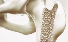 Nguy cơ loãng xương ở nam giới và cách phòng tránh