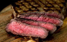 6 điều ít ai ngờ tới lại có thể gây bệnh sỏi thận