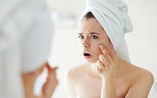 Mụn trứng cá, tác nhân gây trầm cảm?