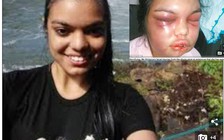 Cô gái trẻ bị chồng bạo hành mỗi khi có người like ảnh cô trên Facebook