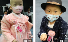 Tổ chức ‘đám cưới’ cho con 2 tuổi bị ung thư để gây quỹ trị bệnh