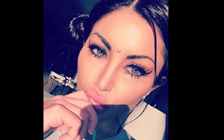 Người mẫu gần như bị mù vì phẫu thuật đổi màu mắt