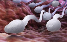 Triệu phú có với vợ 3 con, 20 năm sau mới biết mình bị... vô sinh từ nhỏ