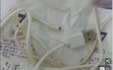 Cậu bé 'nghịch dại' làm sợi cáp điện thoại kẹt trong 'của quý'