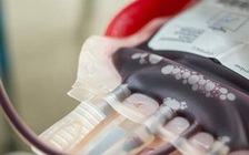 Cậu bé bệnh nhẹ, vào viện được truyền máu rồi... nhiễm HIV