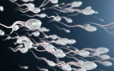 Nam giới vô sinh do tinh dịch không tinh trùng có tuổi thọ thấp