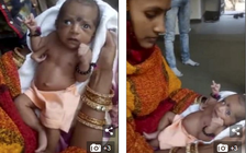 Bé gái Ấn Độ chào đời có 3 cánh tay, được tôn thờ như vị thần