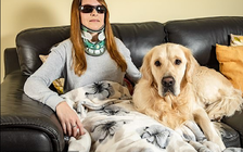 Người phụ nữ mắc bệnh kỳ lạ khiến não tuột khỏi hộp sọ