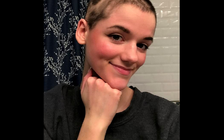 Những người mắc bệnh lạ: Cô gái nghiện giật tóc, nhổ lông cả người