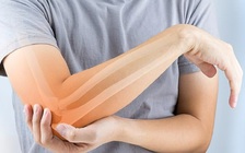 Bế bạn gái 65 kg, chàng trai gãy tay phải... nhập viện