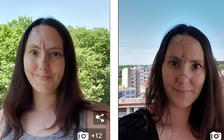 Tưởng mụn trên mũi ai ngờ là... ung thư da