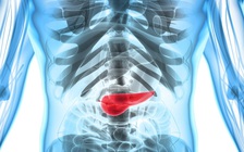 Phương pháp mới giúp điều trị ung giai đoạn cuối