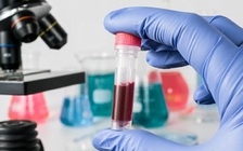 Chỉ cần xét nghiệm máu, có thể phát hiện hơn 20 loại ung thư