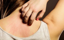 4 kiểu ngứa cảnh báo những căn bệnh ít ai ngờ tới