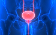 Viên đạn nằm trong bàng quang người đàn ông suốt 18 năm