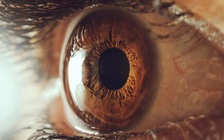 Phát hiện 3 con giun chỉ và trứng giun trong mắt người đàn ông